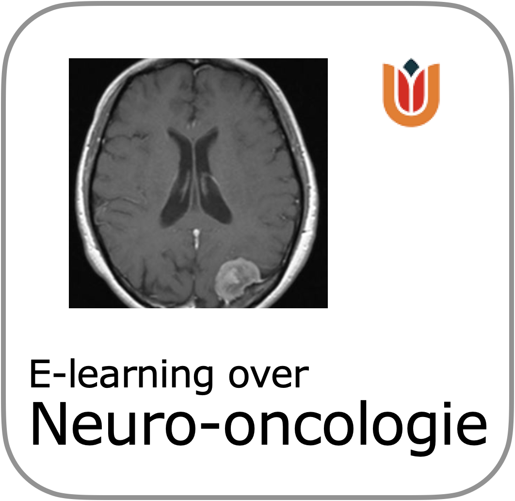 to scorm NeuroOncologie